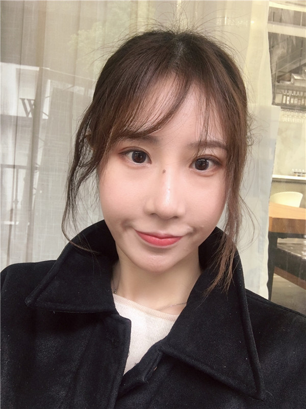 杭州艺星脂肪填充怎么样