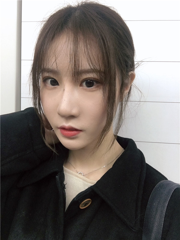 杭州艺星脂肪填充怎么样