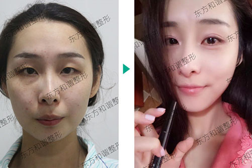 北京东方和谐孙泽芳怎么样