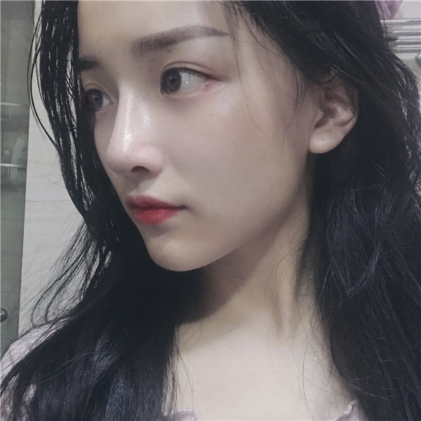 杭州维多利亚隆鼻怎么样?