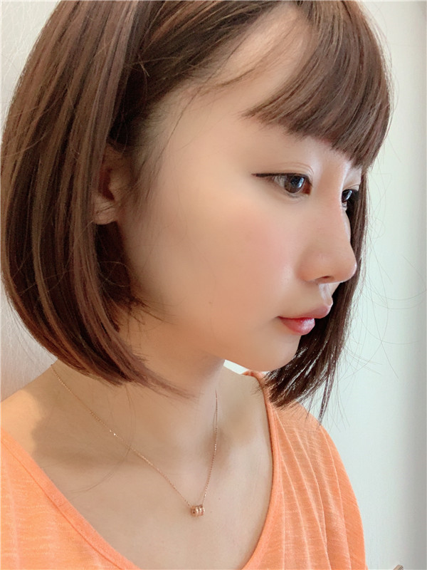 重庆世代美肋软骨隆鼻怎么样?
