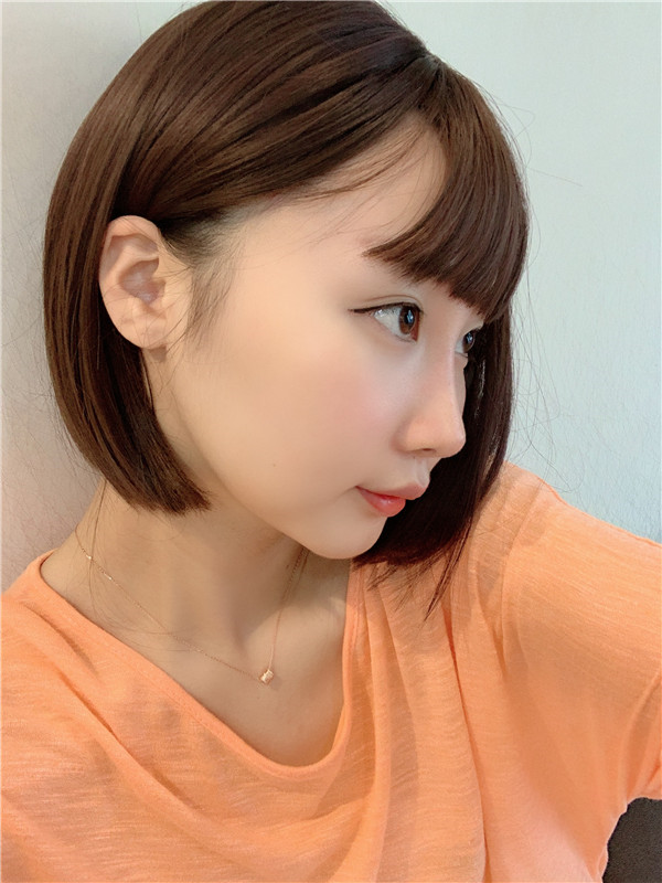 重庆世代美肋软骨隆鼻怎么样?