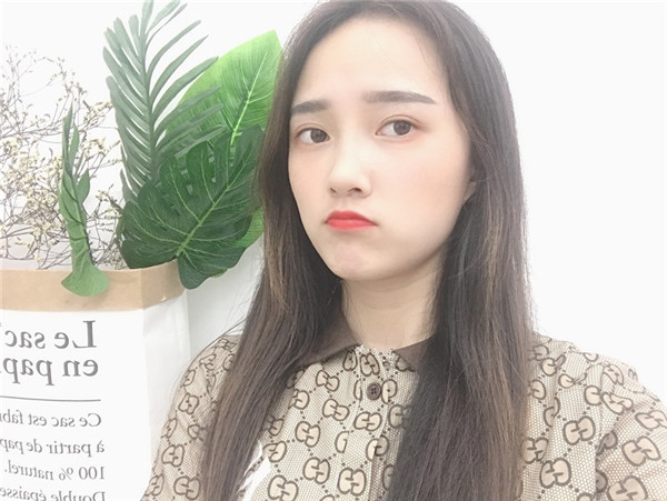 北京惠合嘉美面部提升怎么样?