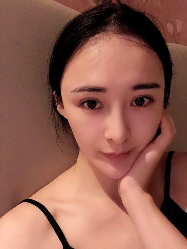 西安瑞诺双眼皮怎么样?
