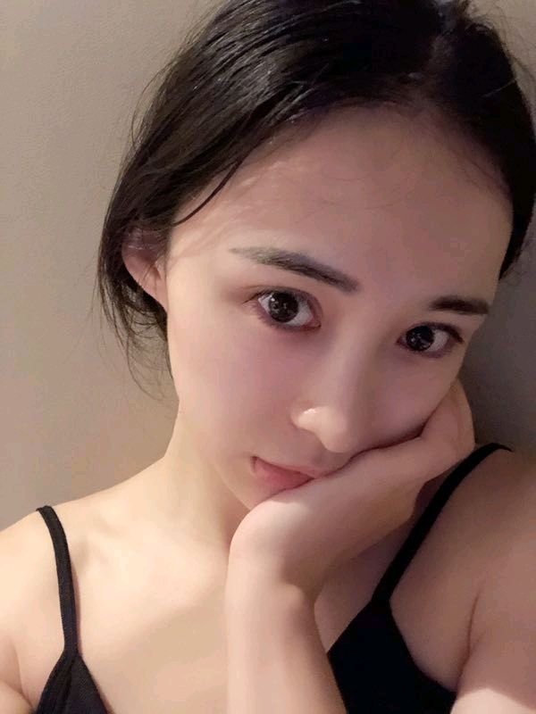 西安瑞诺双眼皮怎么样?