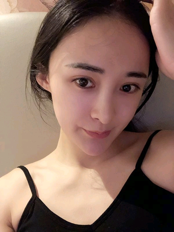 西安瑞诺双眼皮怎么样?