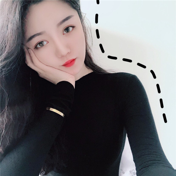 沈阳美联致美脂肪填充怎么样?