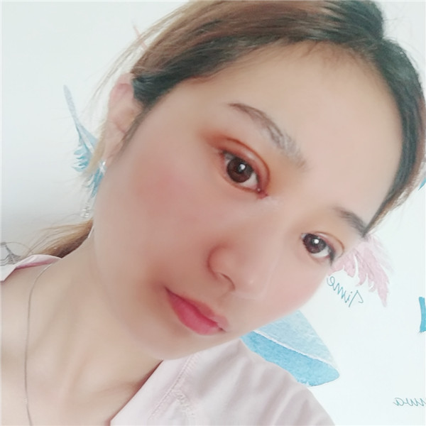 南京柠檬割双眼皮怎么样?