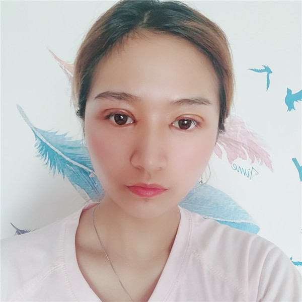 南京柠檬割双眼皮怎么样?