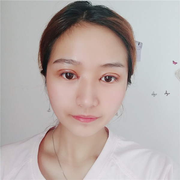 南京柠檬割双眼皮怎么样?