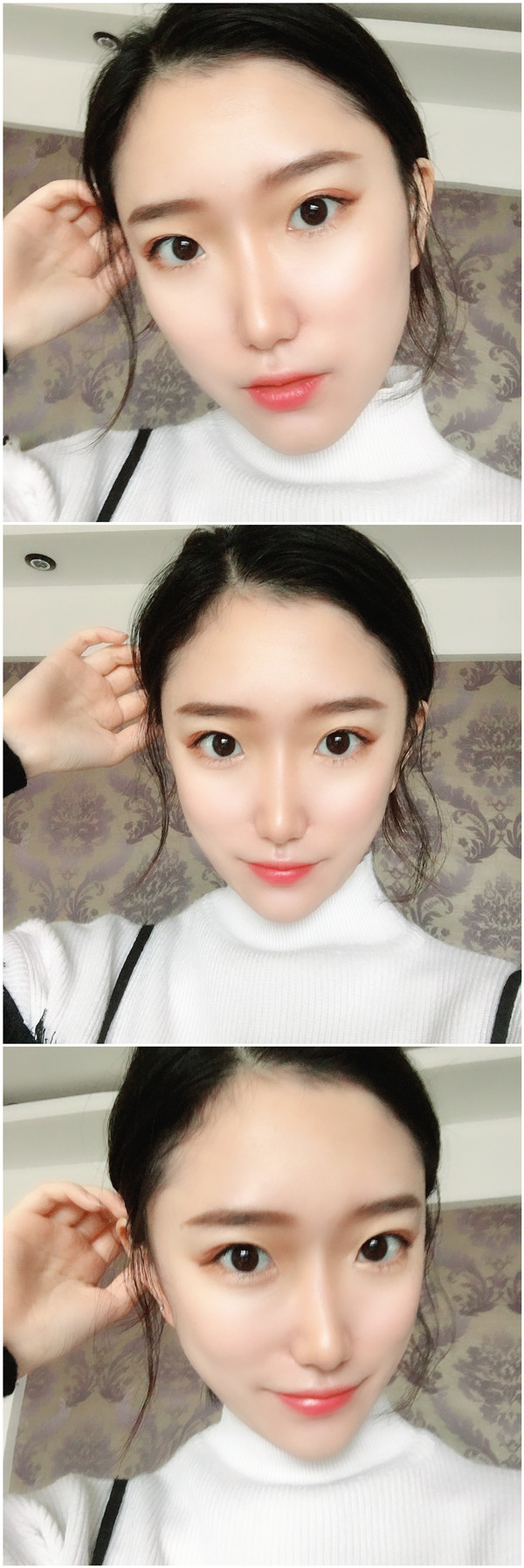 广州古汀脂肪填充怎么样?