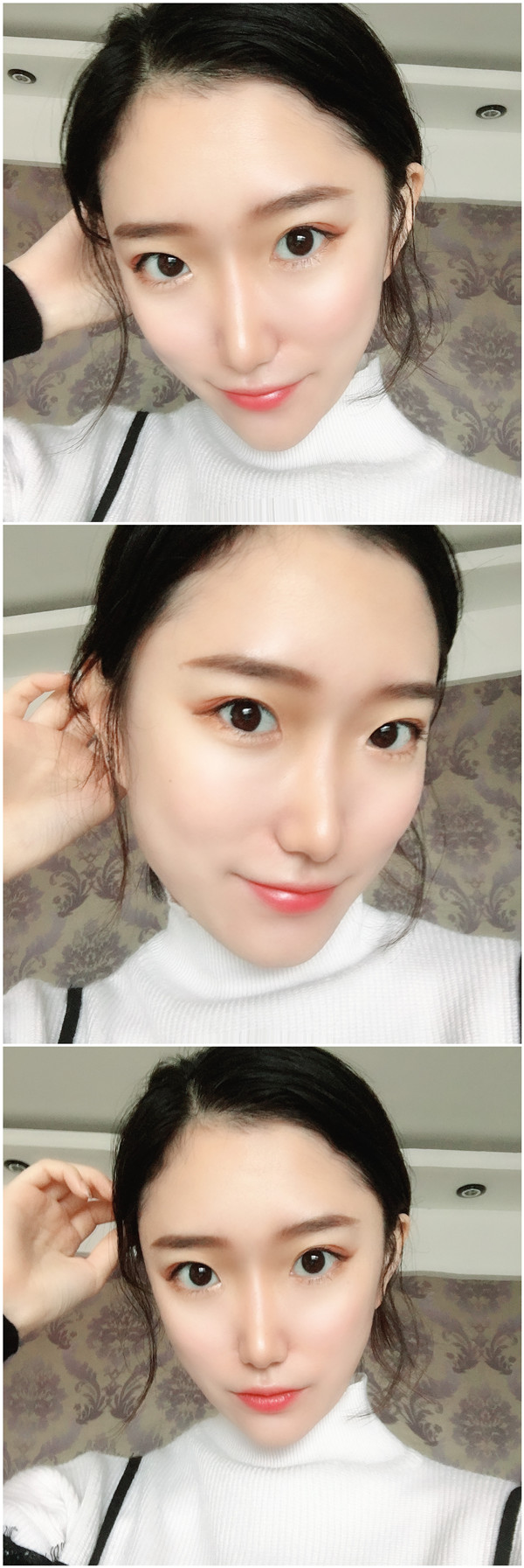 广州古汀脂肪填充怎么样?