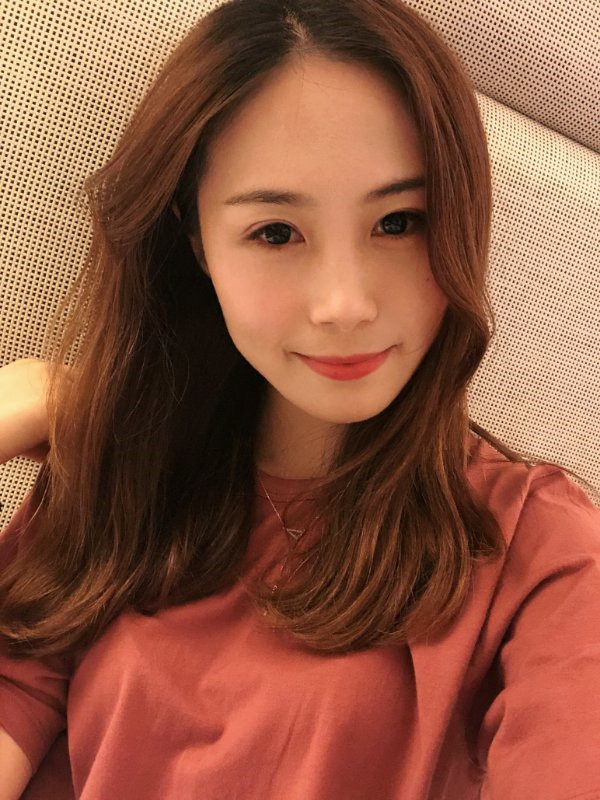 重庆百达丽双眼皮怎么样?