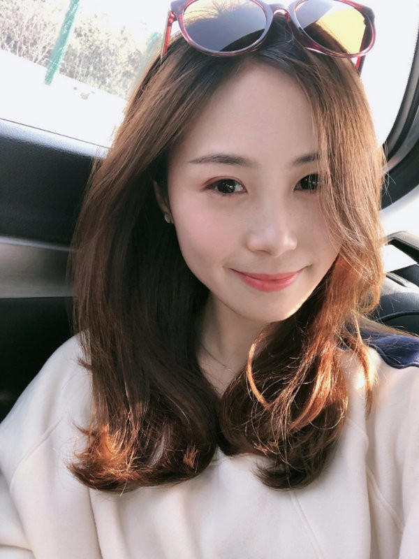 重庆百达丽双眼皮怎么样?