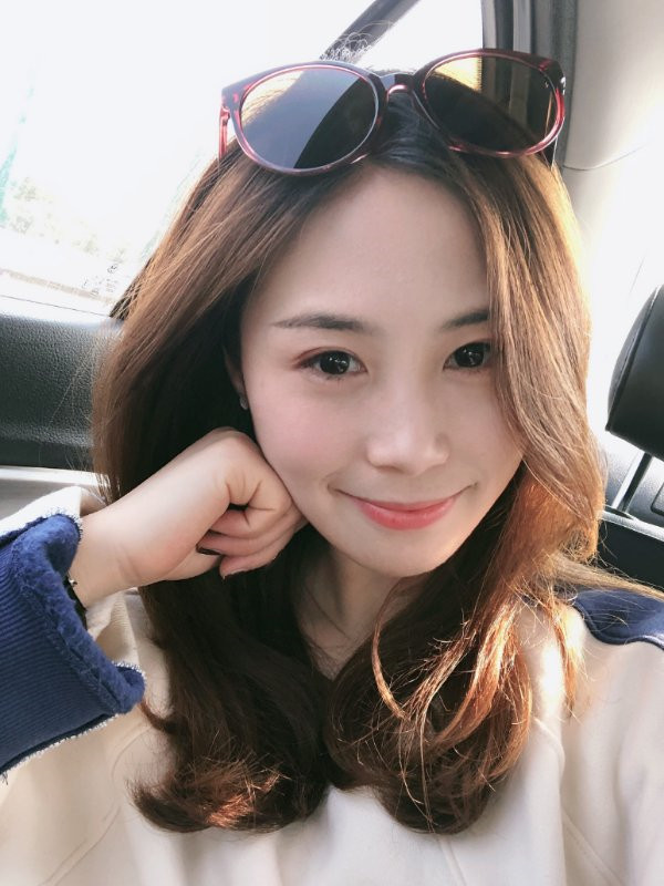 重庆百达丽双眼皮怎么样?