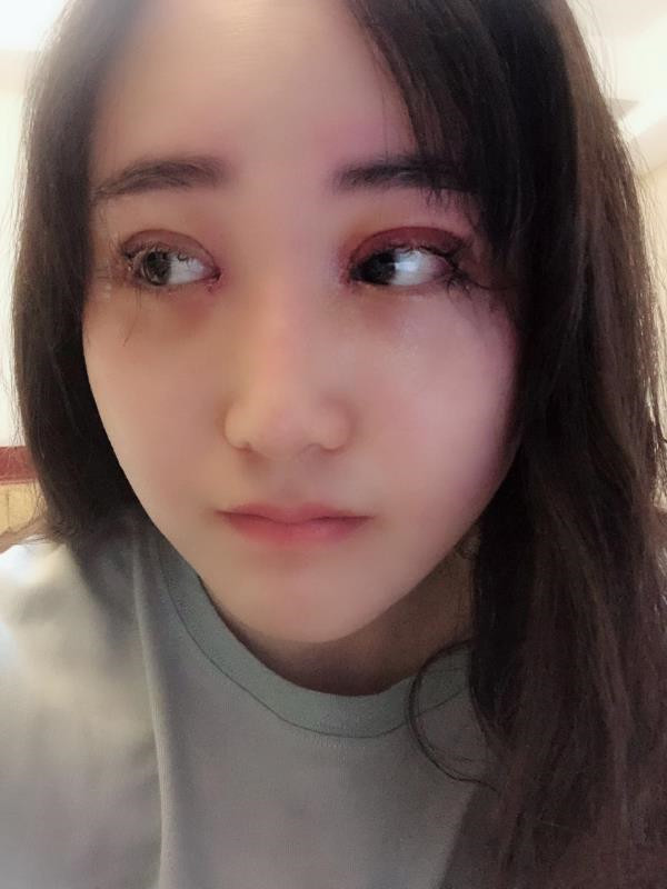 北京玲珑梵宫双眼皮怎么样?