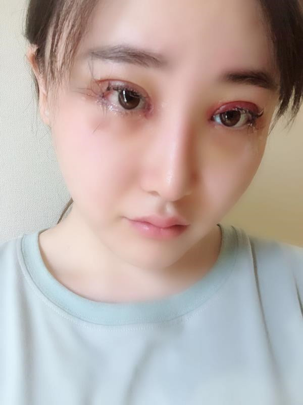 北京玲珑梵宫双眼皮怎么样?