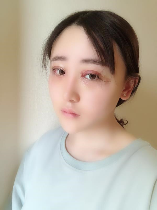 北京玲珑梵宫双眼皮怎么样?