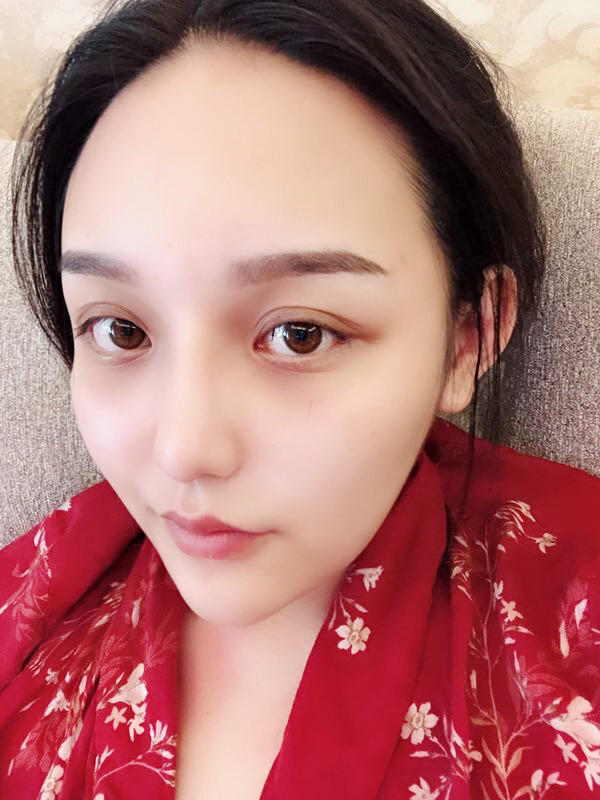 北京玲珑梵宫隆鼻怎么样?