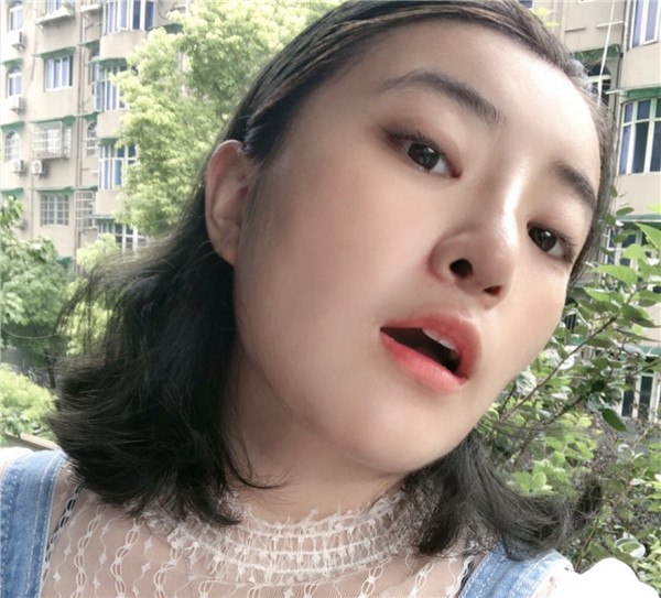 北京凯润婷双眼皮怎么样?