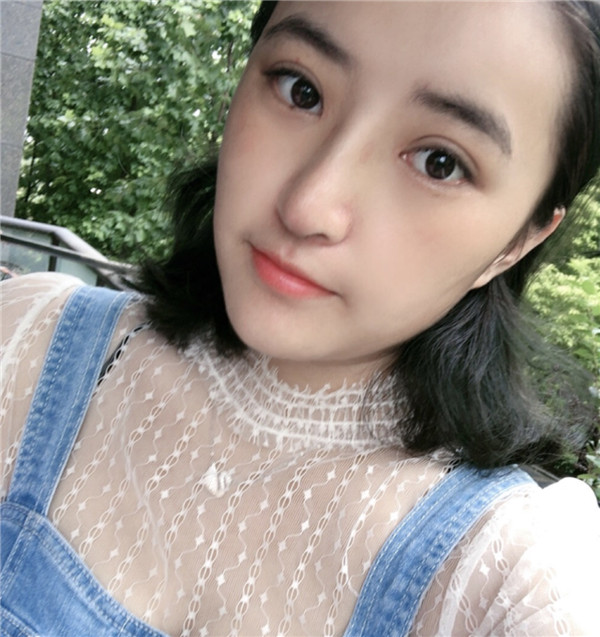 北京凯润婷双眼皮怎么样?