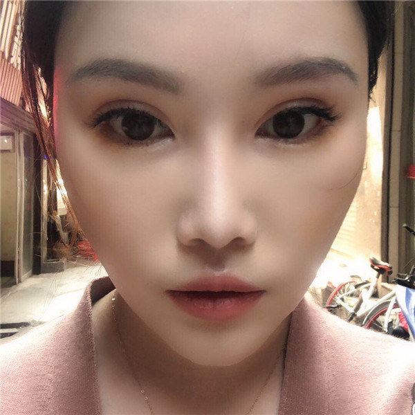 武汉奥黛丽吸脂怎么样?