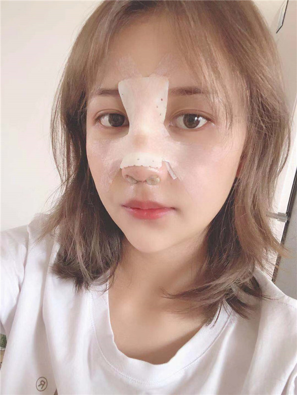 云南华美美莱隆鼻怎么样?