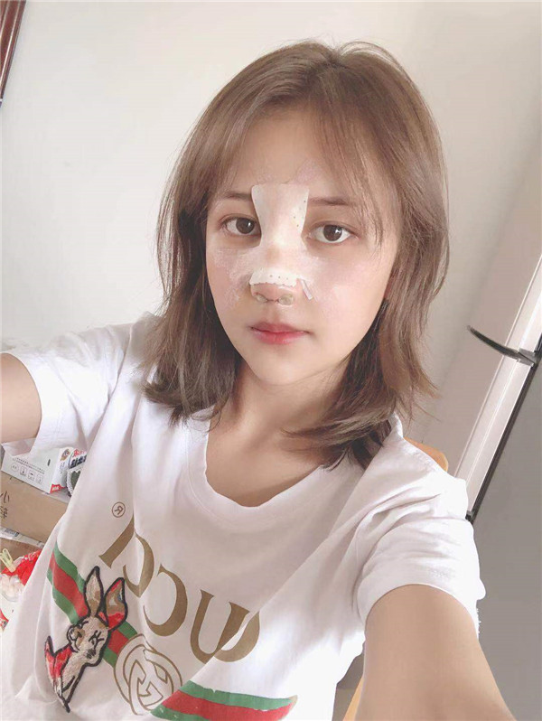 云南华美美莱隆鼻怎么样?