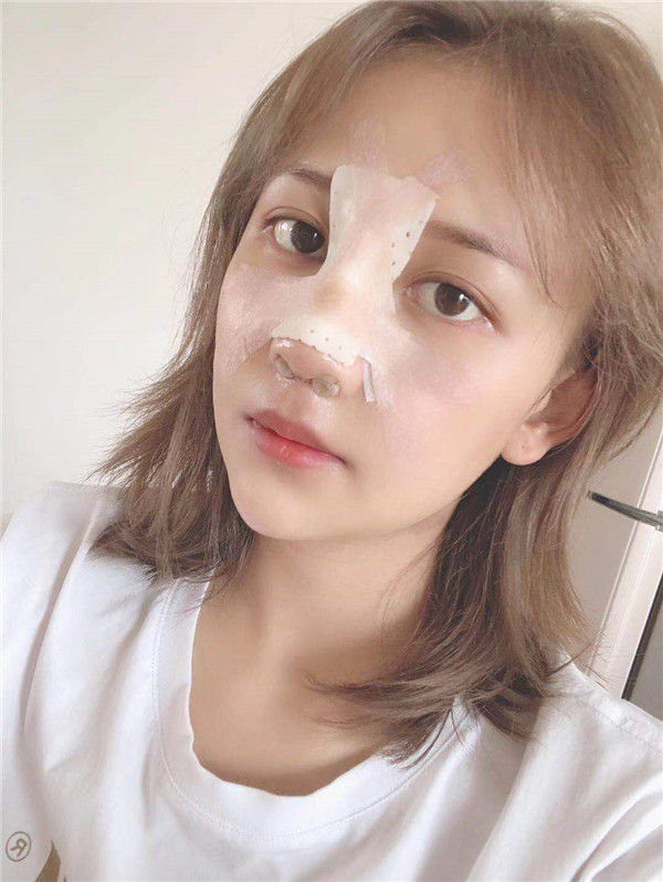 云南华美美莱隆鼻怎么样?