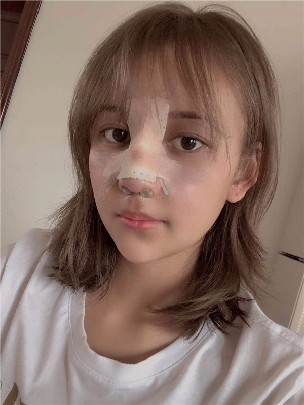 云南华美美莱隆鼻怎么样?