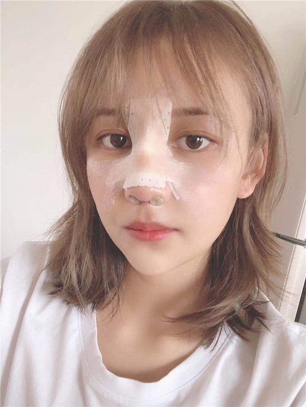 云南华美美莱隆鼻怎么样?