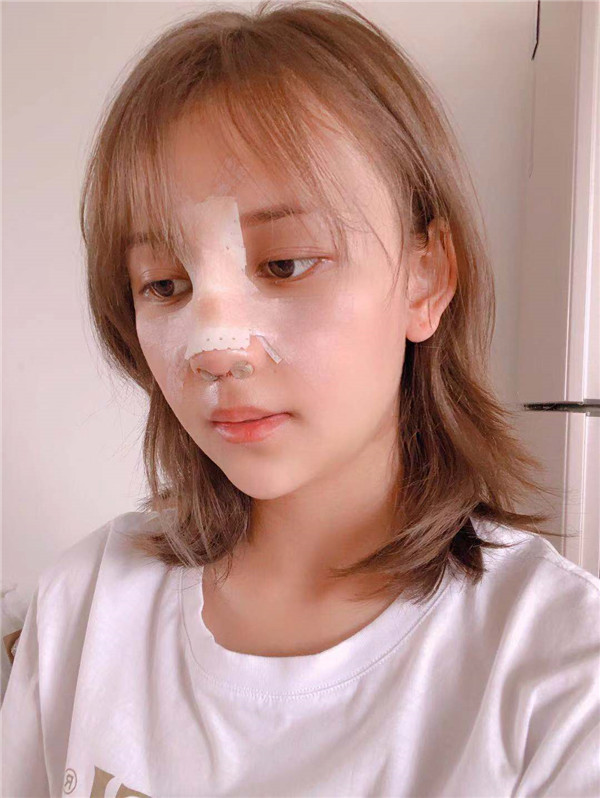 云南华美美莱隆鼻怎么样?