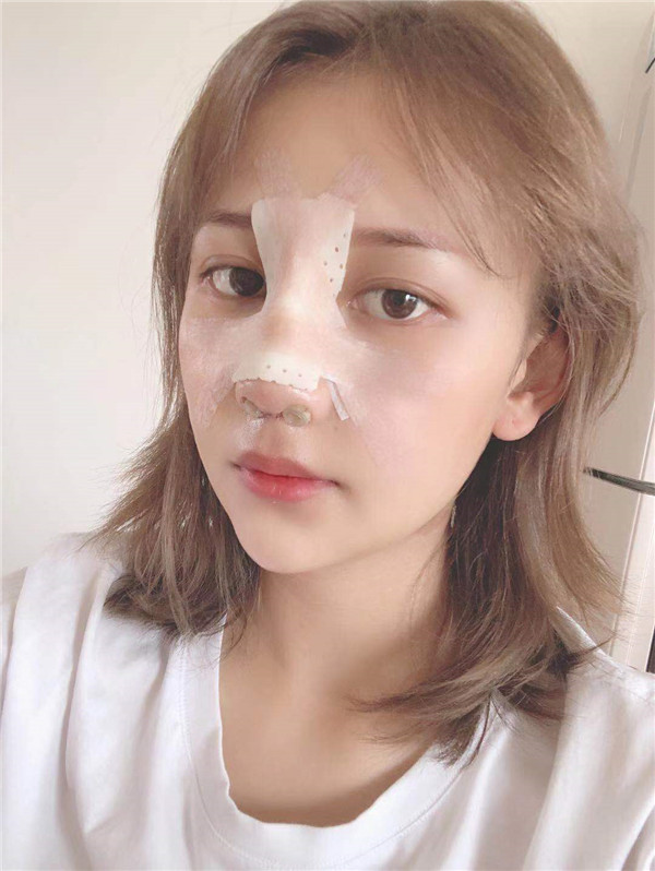 云南华美美莱隆鼻怎么样?