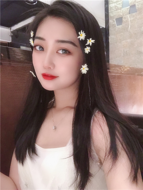 深圳艺星双眼皮怎么样?