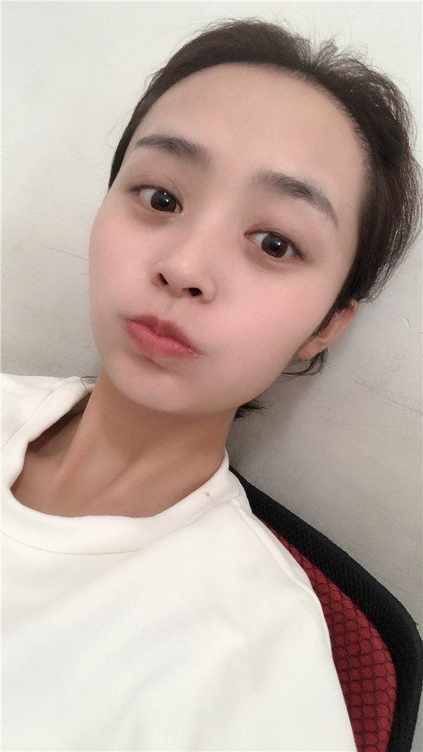 北京南加植发怎么样?