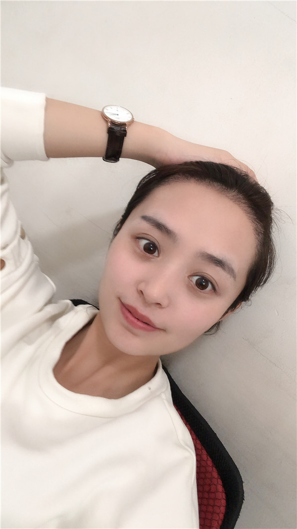 北京南加植发怎么样?