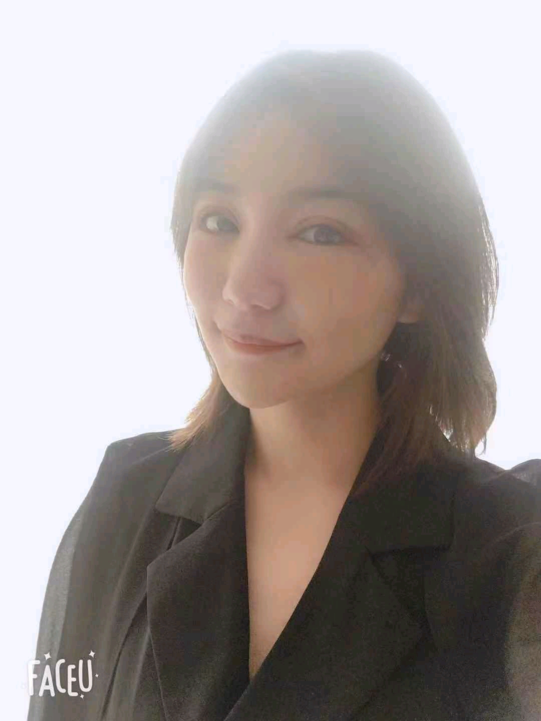 黑龙江超龙双眼皮怎么样