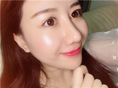 杭州时光肋软骨隆鼻怎么样?