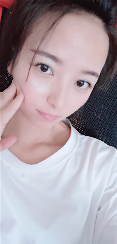 北京悦丽汇双眼皮怎么样?