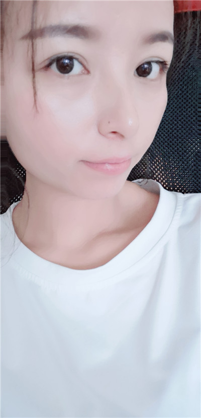 北京悦丽汇双眼皮怎么样?