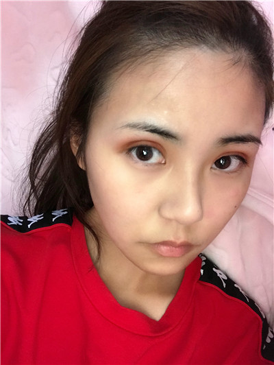 广东画美切开双眼皮怎么样