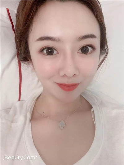 北京悦丽汇隆鼻怎么样?