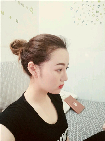 深圳美芮吸脂怎么样?